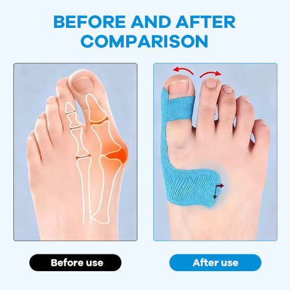 🏆🦶Medical-Grade Bunion Tape – 🦶Hypoallergenic, Breathable, Painless Removal👟
