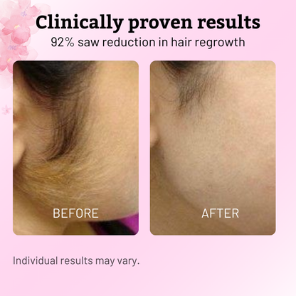 🏆AEXZR®Pain-Free Hair Removal Alternative – ✨Gentle, Soothing, No Harsh Chemicals🌿