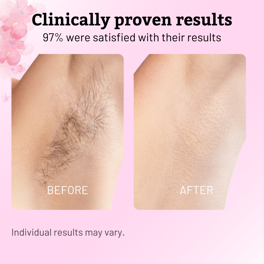 🏆AEXZR®Pain-Free Hair Removal Alternative – ✨Gentle, Soothing, No Harsh Chemicals🌿