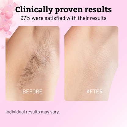 🏆AEXZR®Pain-Free Hair Removal Alternative – ✨Gentle, Soothing, No Harsh Chemicals🌿