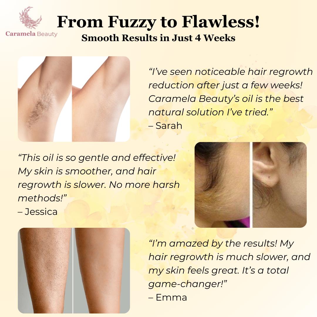 🏆AEXZR®Pain-Free Hair Removal Alternative – ✨Gentle, Soothing, No Harsh Chemicals🌿