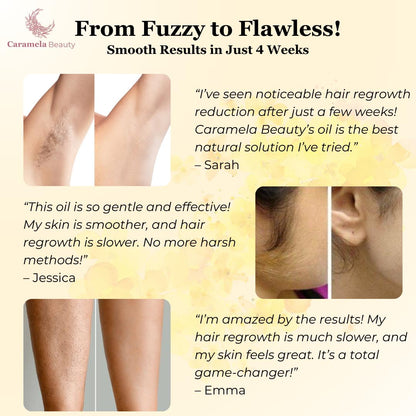 🏆AEXZR®Pain-Free Hair Removal Alternative – ✨Gentle, Soothing, No Harsh Chemicals🌿